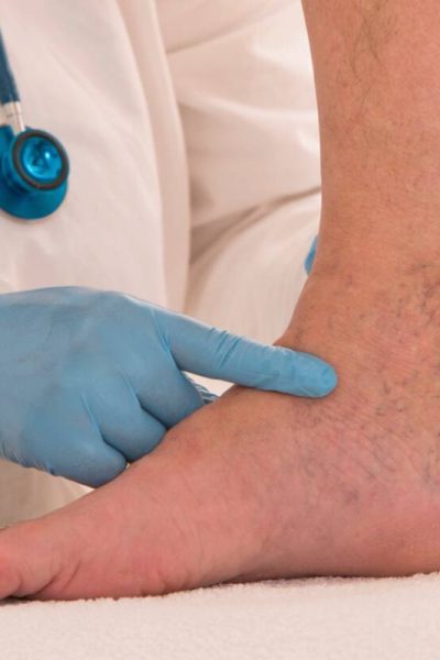 درمان‌های تخصصی واریس در شیراز