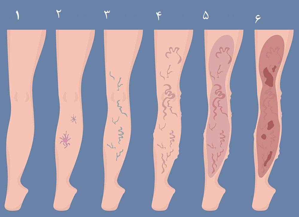 بهترین کلینیک های واریس در شیراز ۱۴۰۴ — بررسی تخصصی، آدرس، شماره تماس و نظرات
