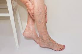 بهترین دکتر واریس زنان در شیراز(لیست کامل بروز شده)