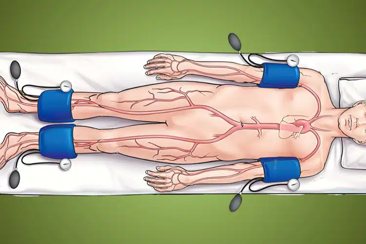 تست بررسی ABI (Ankle-Brachial Index) — راهنمای کامل تشخیص گرفتگی عروق محیطی (PAD)، نحوه انجام، تفسیر نتایج و نوبت‌دهی